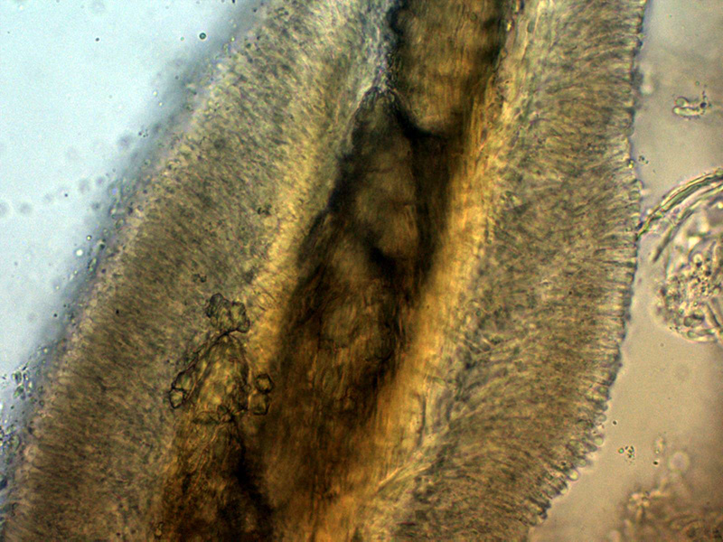 Un hydnoide corticale da identificare